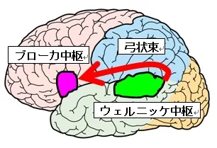 ウェルニッケ中枢